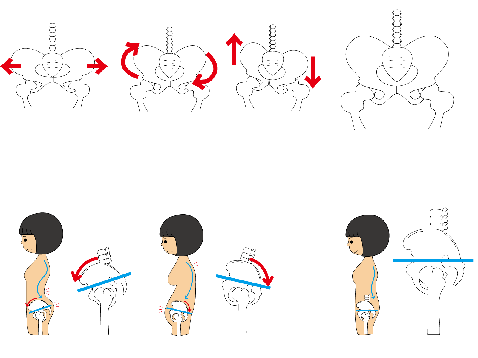 骨盤矯正のイメージ